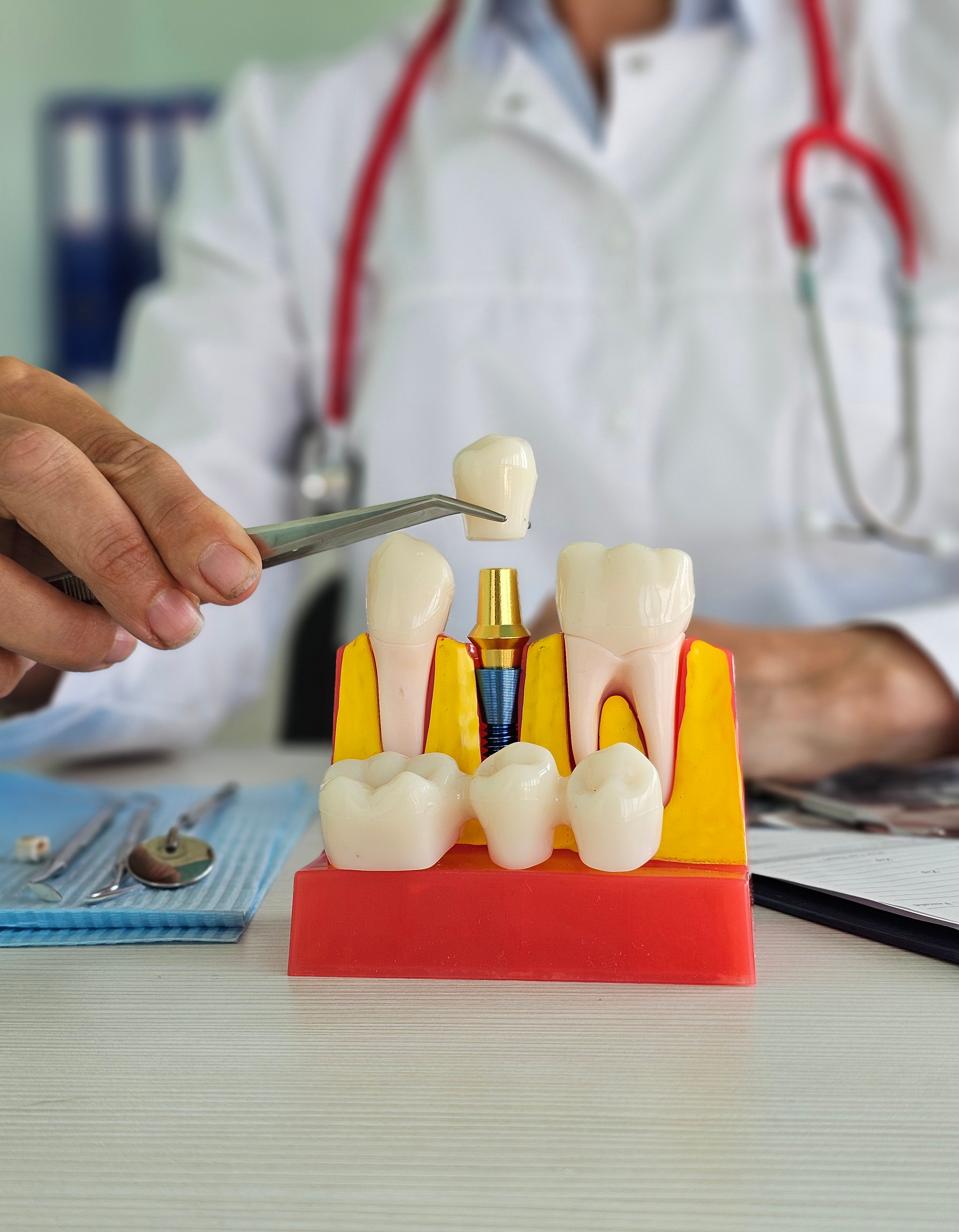 Digital implant workflow: precision and efficiency