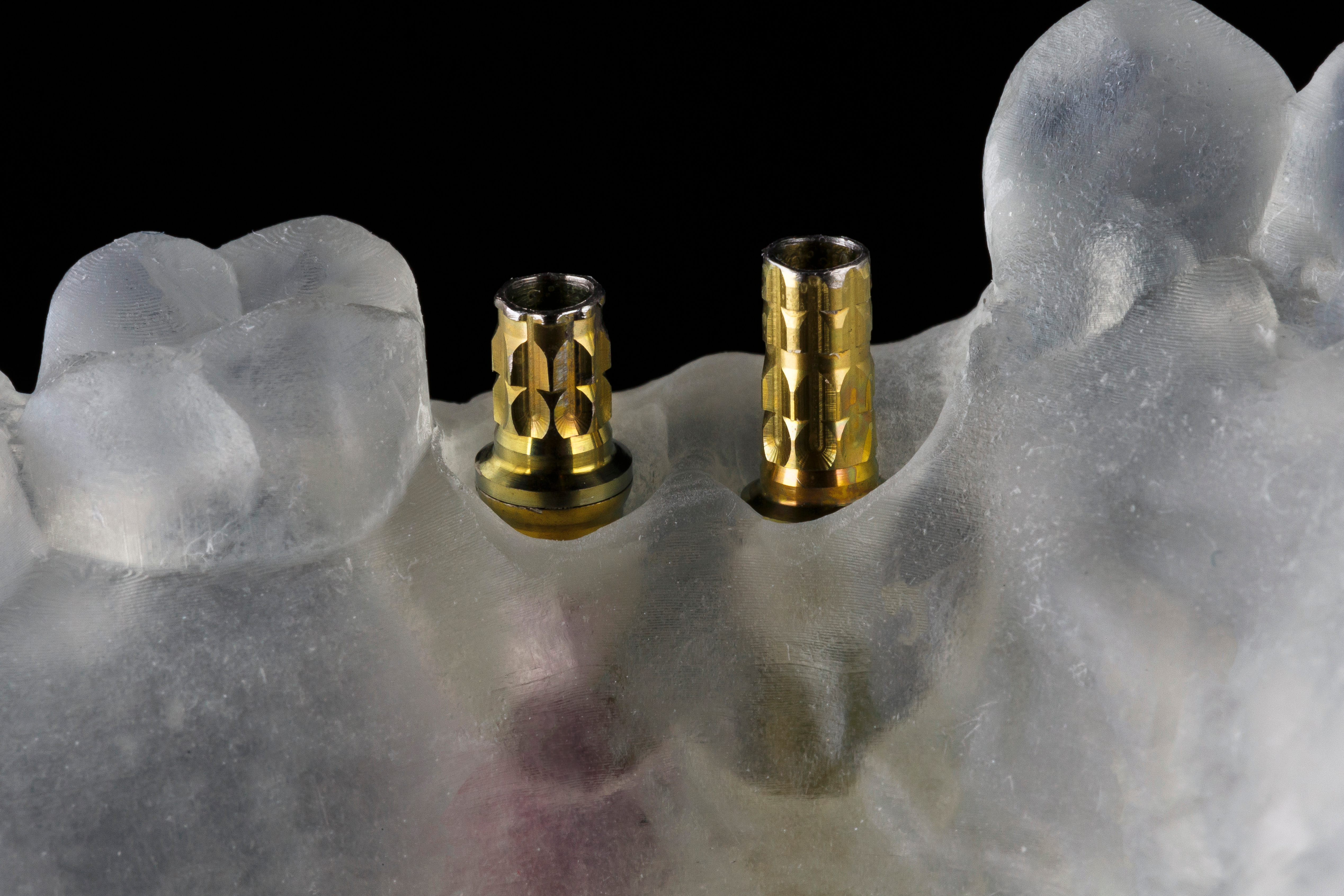 Verification protocols explained: ensuring accuracy in dental implants 3d printi