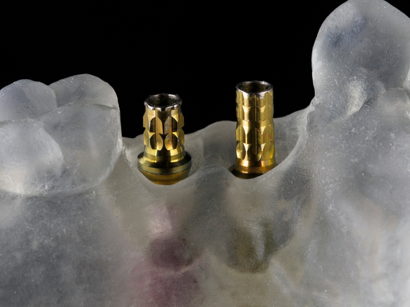 Verification protocols explained: ensuring accuracy in dental implants 3d printi